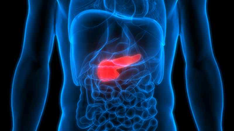 What is Stage 4 Pancreatic Cancer?